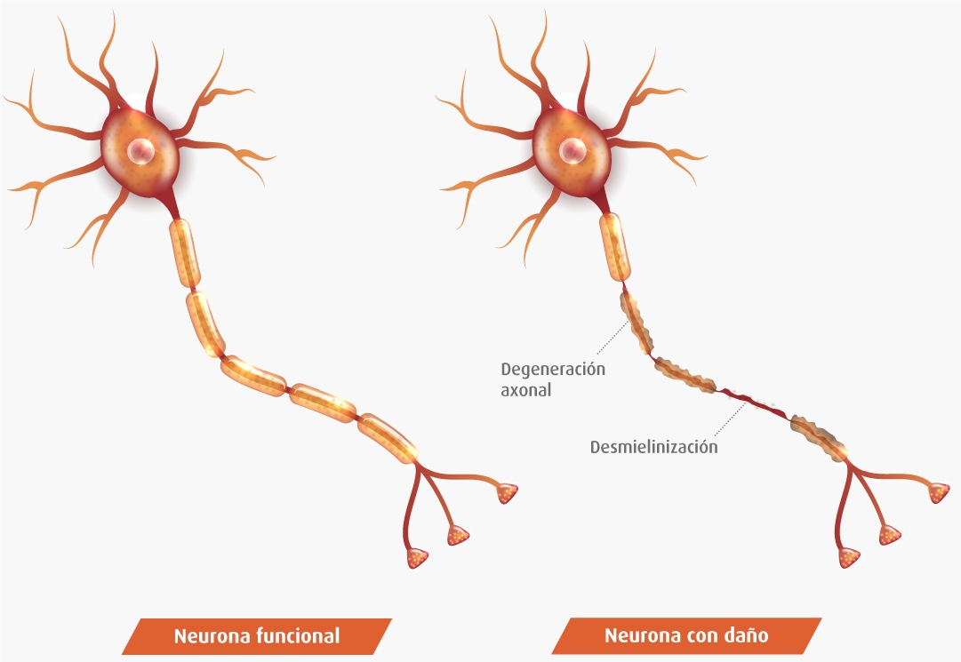 Lesiones
