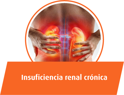 Insuficiencia renal crónica